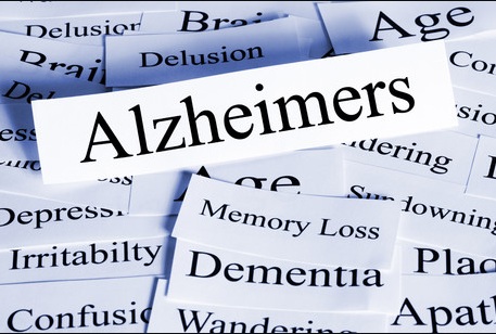 DEMENTIA ALZHEIMER